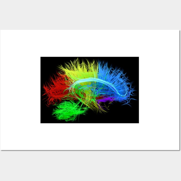 Human brain nerve tracts, illustration, (F035/7627) Wall Art by SciencePhoto